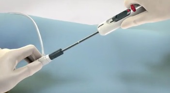 The Vivasure large-hole closure device from Vivasure Medical Ltd